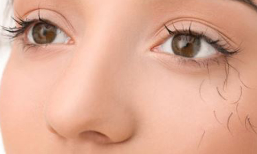 Eyelash Loss Treatment in Brantford Ontario