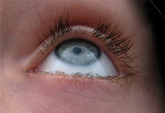 Treatments for Eyelash Loss in Brantford Ontario